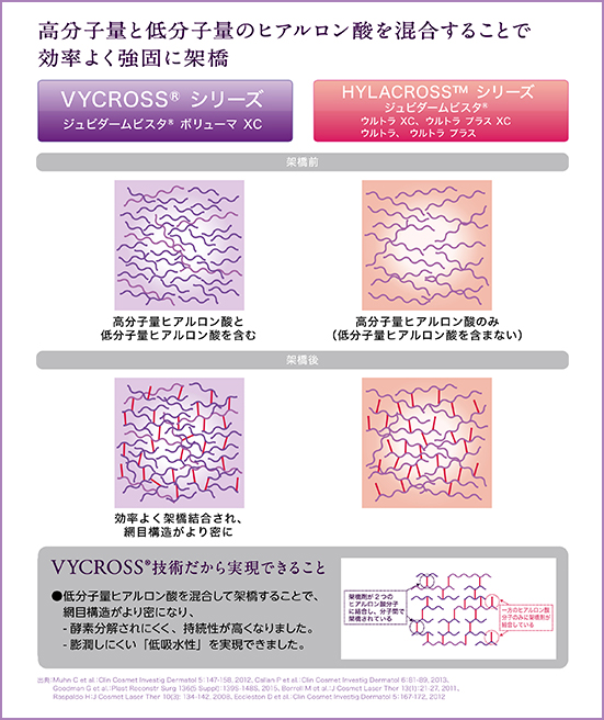 VYCROSS®シリーズ