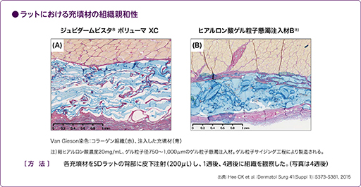 ジュビダームビスタ®ボリューマXC は組織と親和していることが確認されました。