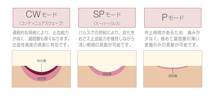 搭載されているパルスモードと組織への作用